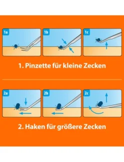 ARDAP Zeckenzange Edelstahl